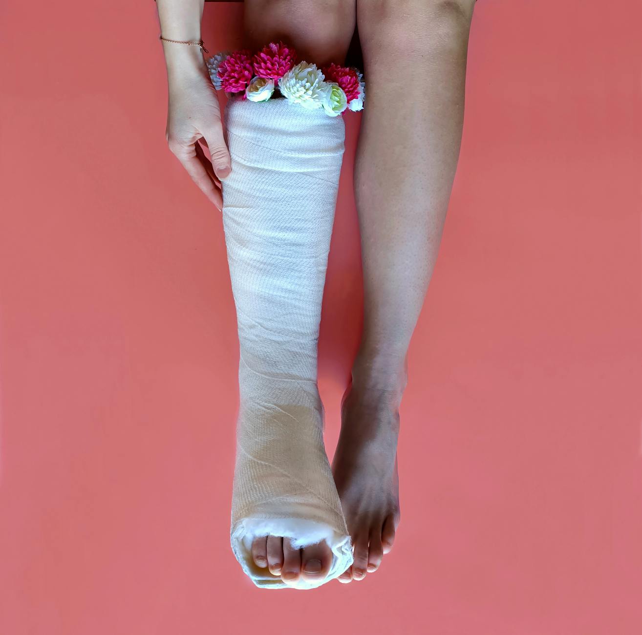 a person with a cast on her leg